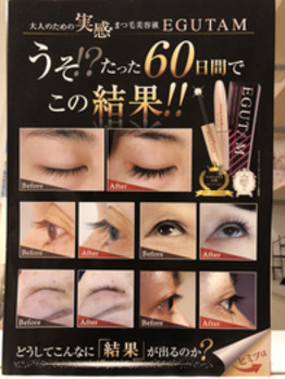 大人気まつ毛美容液!エグータム☆_20180728_1